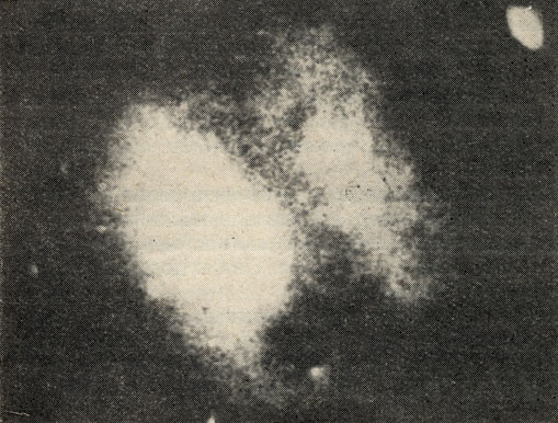 Рис. 59. Фотография в инфракрасных лучах части галактического ядра
