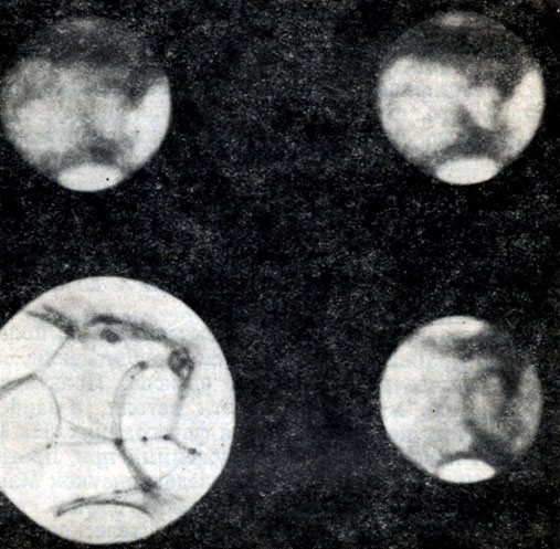 Рис. 128. Рисунки и фотоснимки Марса. Верхние изображения представляют собой непосредственные фотоснимки Марса. Нижнее левое изображение - рисунок. Нижнее правое изображение - фотоснимок этого рисунка, полученный с помощью того же телескопа, который применялся для фотографирования Марса