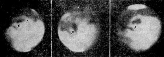 Рис. 130. Изменения на Марсе. Вверху: Озеро солнца в 1911, 1926 и 1939 гг. (слева направо). Средний снимок: изменение в окрестности Леса Циклопов и Залива Гомера, слева - в 1907 г., справа - в 1939 г.